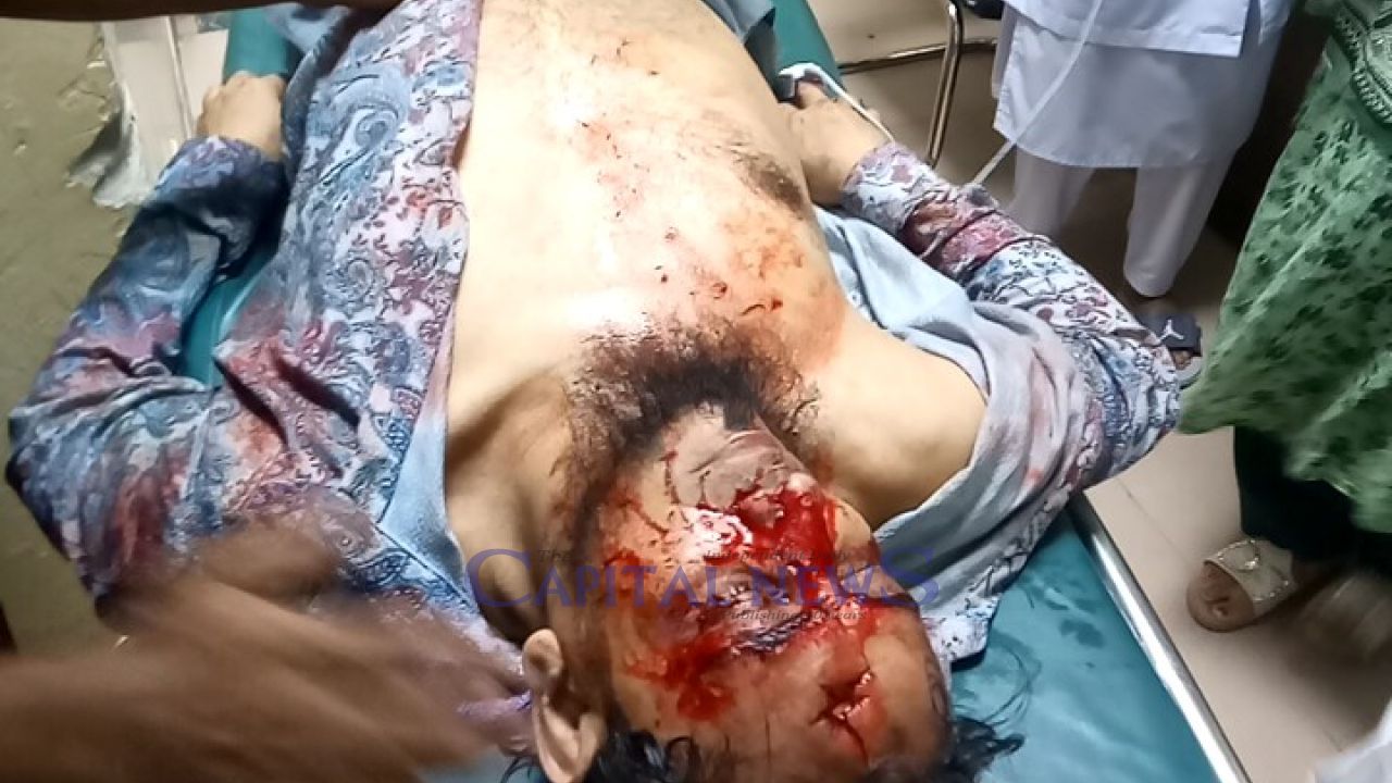 Police crack down on Islami Bank customers' peaceful human chain: 50 shot, over 100 injured
